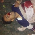 شاهد بالصور .. مقتل منفّذ عملية السطو على محل صرافة بشارع الرباط بصنعاء