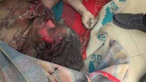 ضحايا غارات العدوان - سوق الخفجي سحار - صعدة 31 مايو 2015 (9)