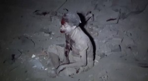 ضحايا غارات العدوان - مبنى قيادة الاركان العليا - صنعاء 7 يونيو2015 (6)
