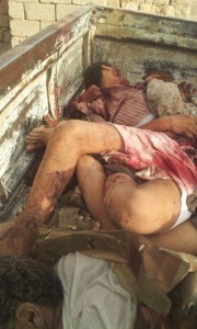 مجزرة العدوان السعودي بحق جنود اللواء 23 ميكا - العبر  - حضرموت (1)