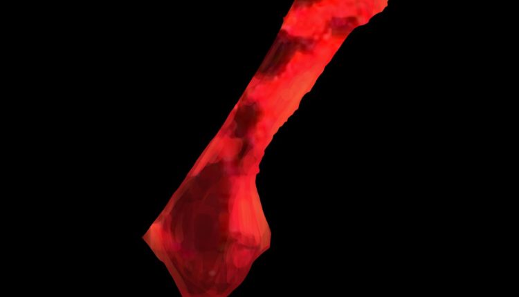 القمر الدموي الاستثنائي في (غزة)